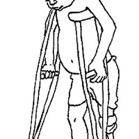 Desenho de Menino com perna apuntada usando muletas para colorir