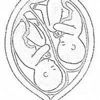 Desenho de Bebês gêmeos no útero para colorir